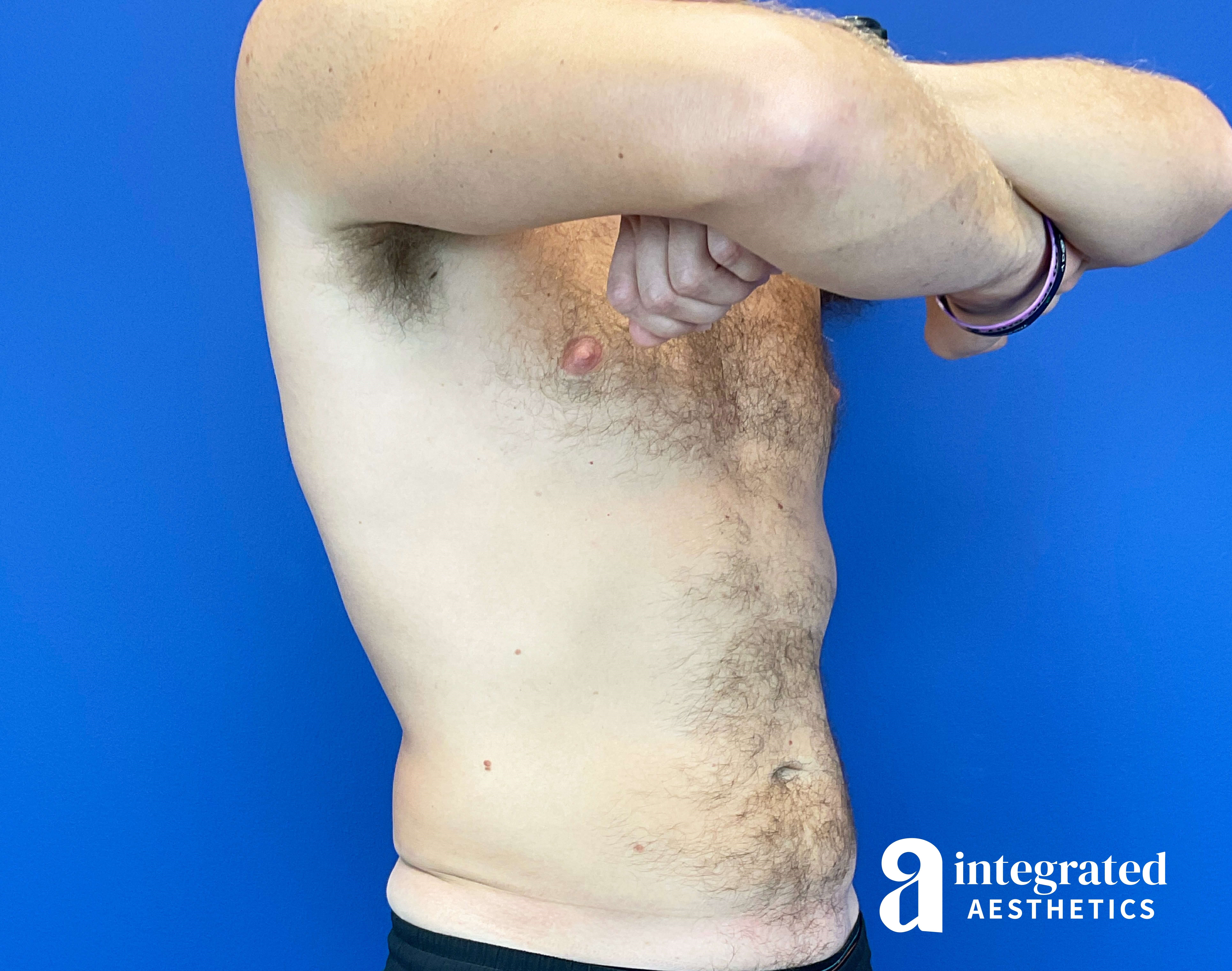 Oblique View After