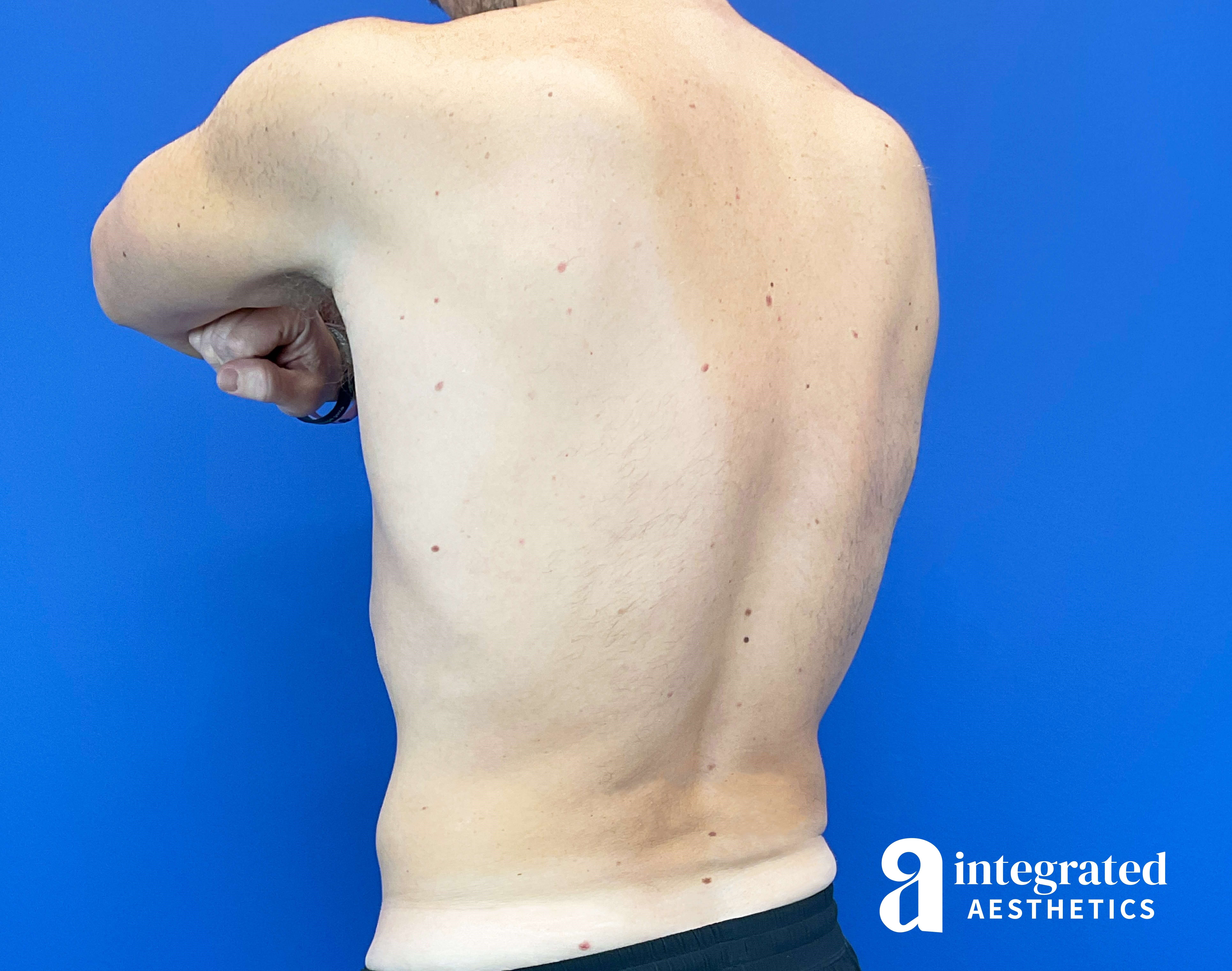 Oblique Back View After
