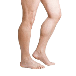 Thigh Lift