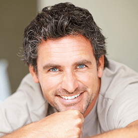 Microneedling with PRF 