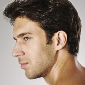 Cheek Augmentation